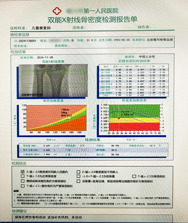 雙能X射線骨密度儀檢測報(bào)告中的T值與Z值的深度解讀